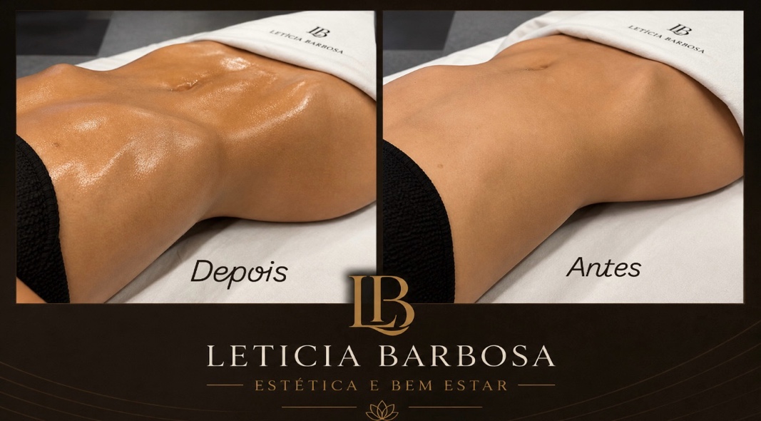 Resultado de tratamento na Clínica Letícia Barbosa