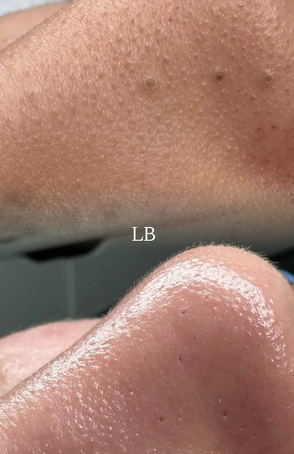 Resultado de tratamento na Clínica Letícia Barbosa